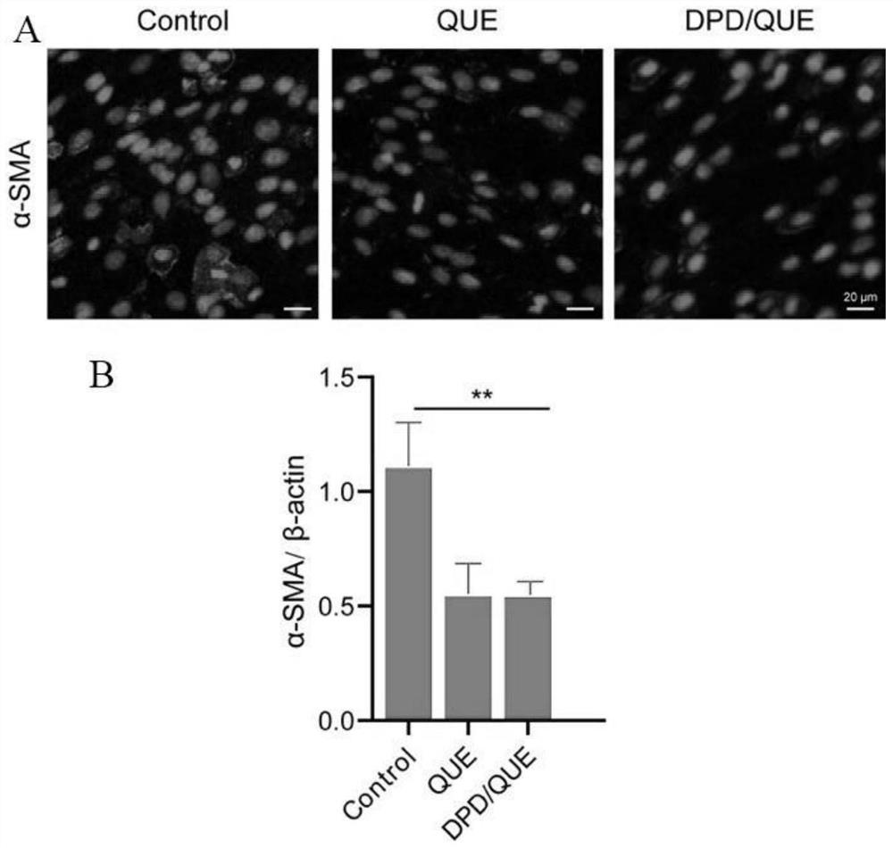 Preparation and application of amphiphilic glucan derivative carrier targeting tumor-associated fibroblasts and its pharmaceutical composition