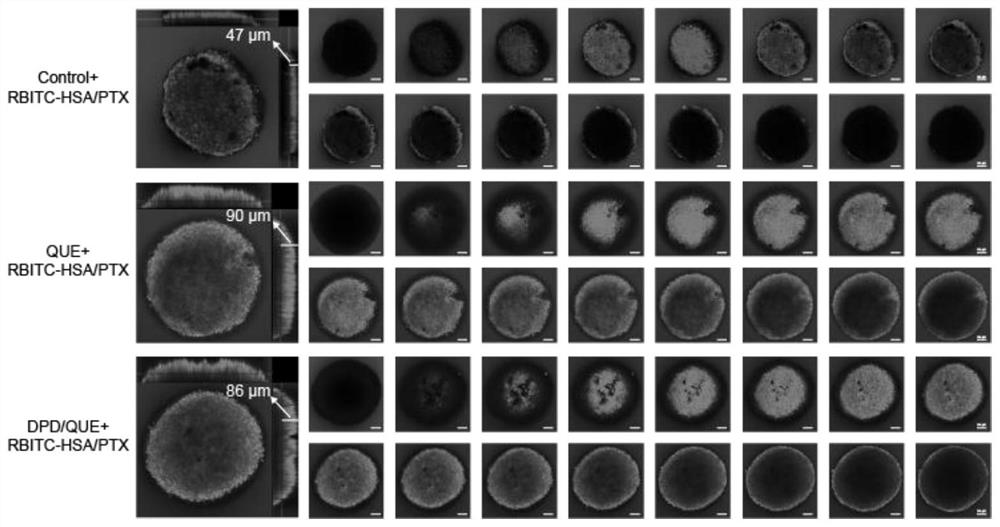 Preparation and application of amphiphilic glucan derivative carrier targeting tumor-associated fibroblasts and its pharmaceutical composition