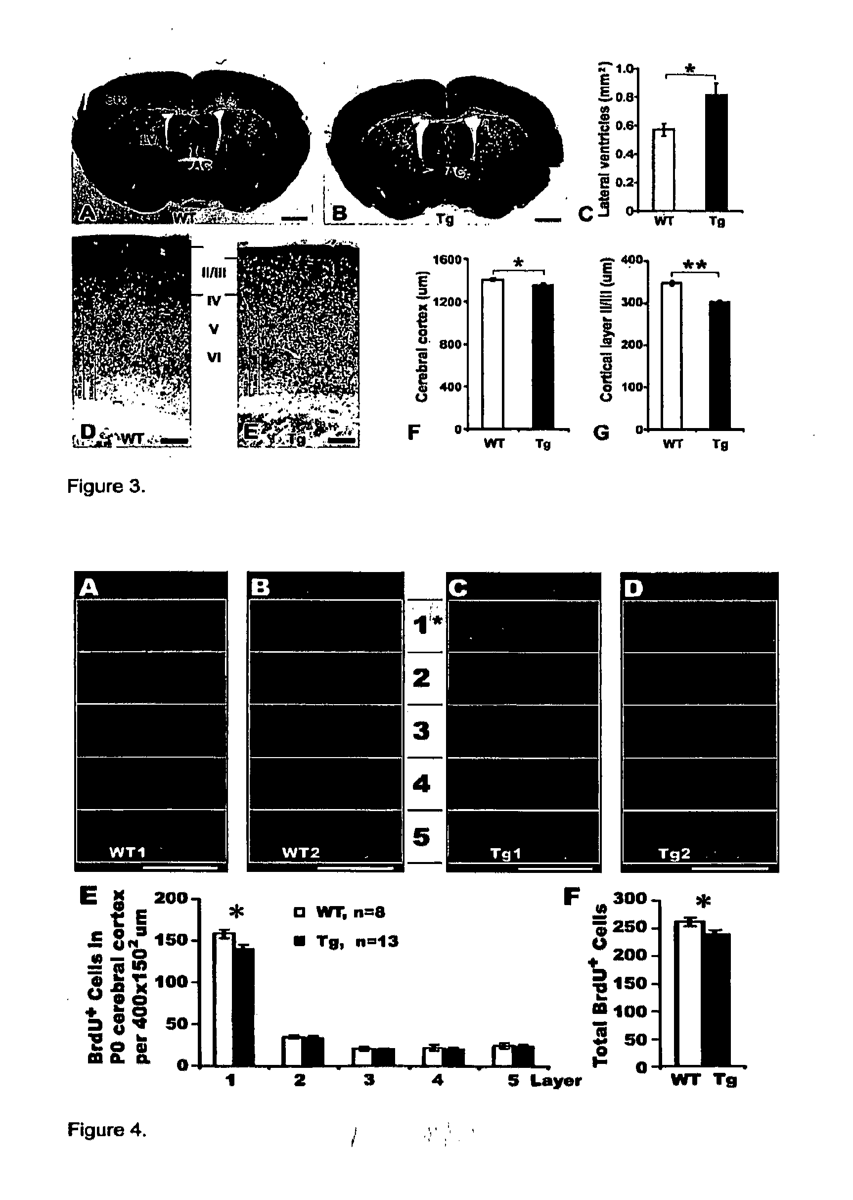 Transgenic rodent expressing truncated disc1