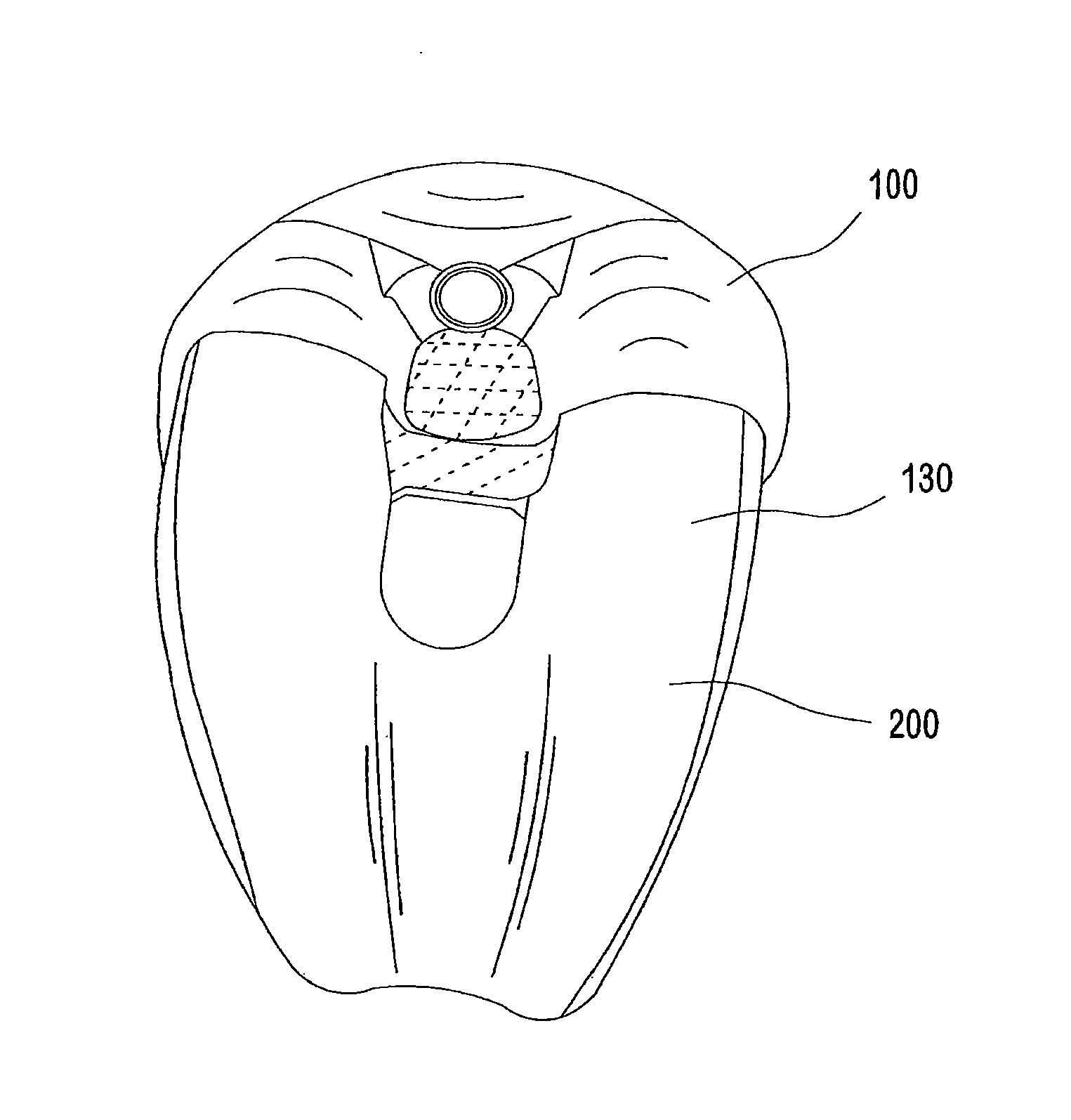 Knee prosthesis