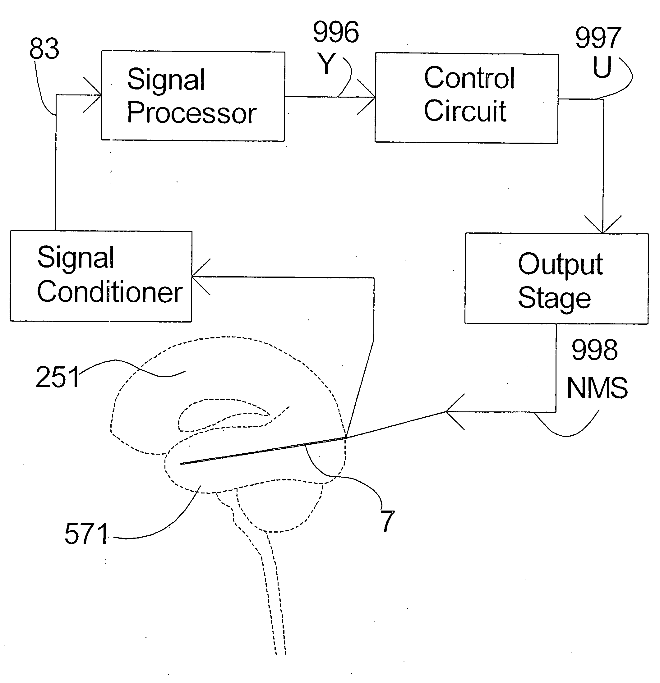 Methods and systems for determining subject-specific parameters for a neuromodulation therapy