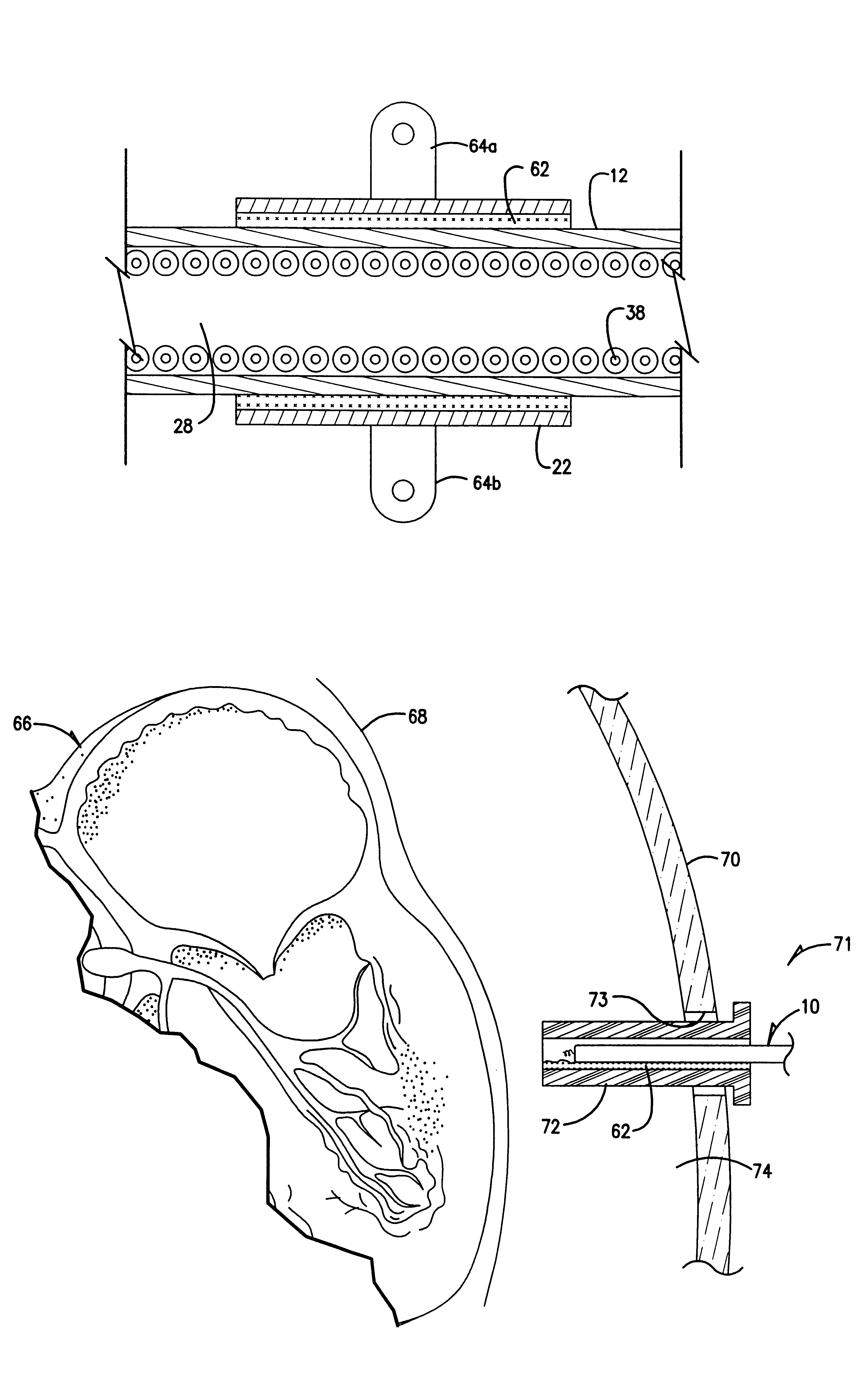 Cardiac lead with active fixation and biocompatible lubricant