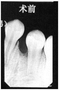 Inflammation-diminishing paste for dental pulp, and preparation method of inflammation-diminishing paste