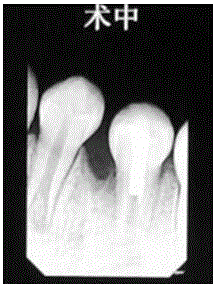 Inflammation-diminishing paste for dental pulp, and preparation method of inflammation-diminishing paste