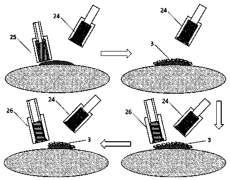 Tumor surgical resection system