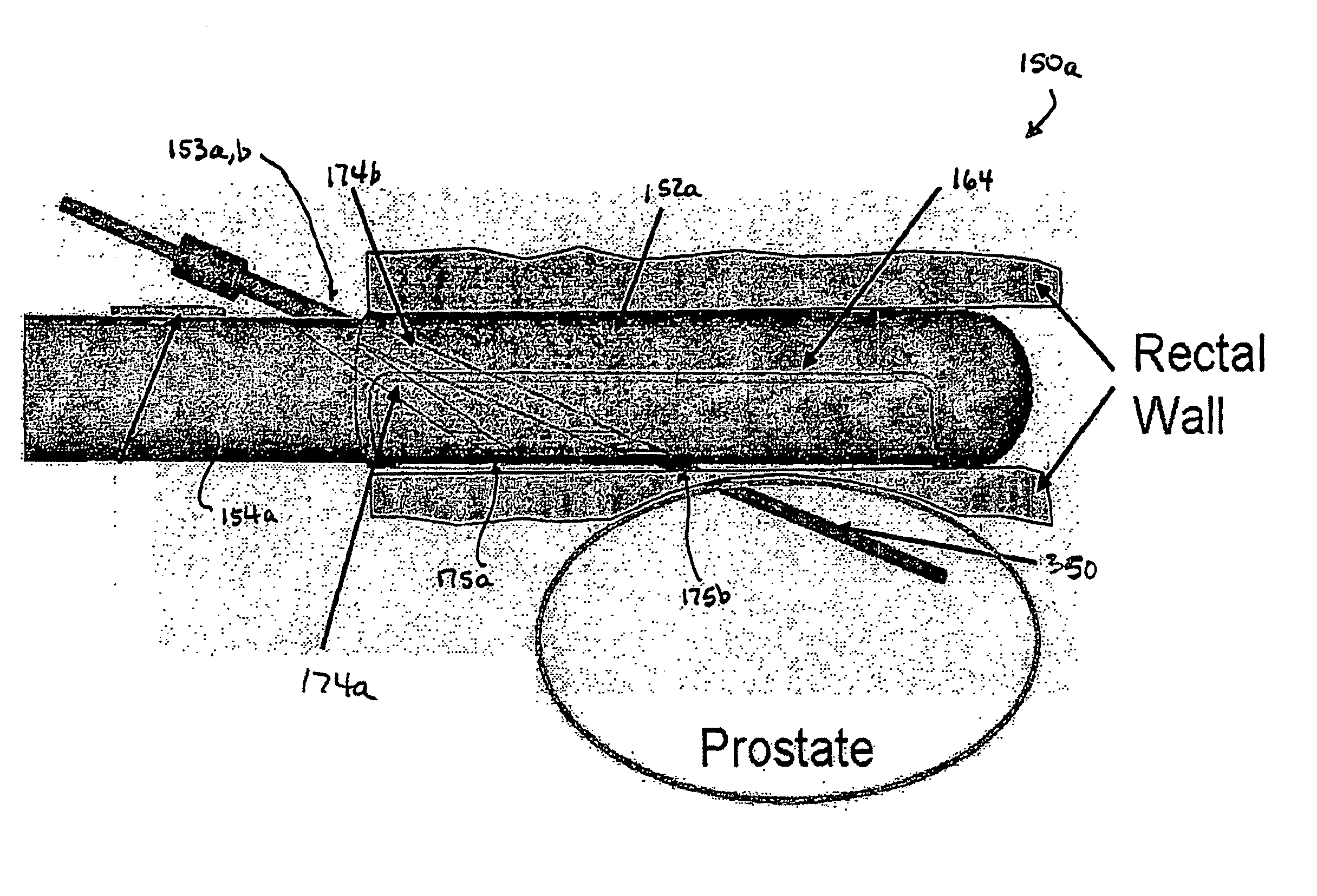 Apparatus for insertion of a medical device within a body during a medical imaging process