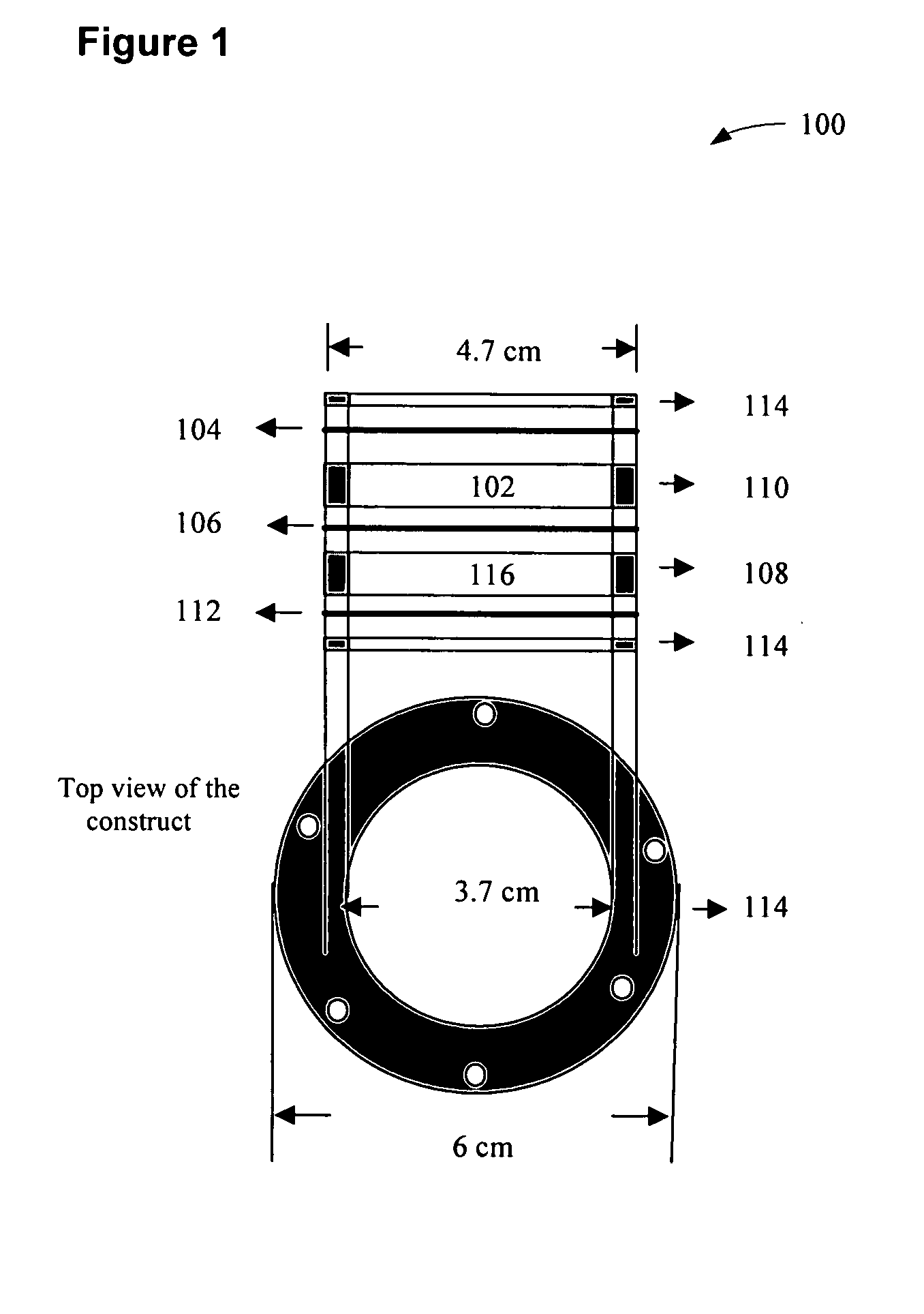 Insulin delivery system