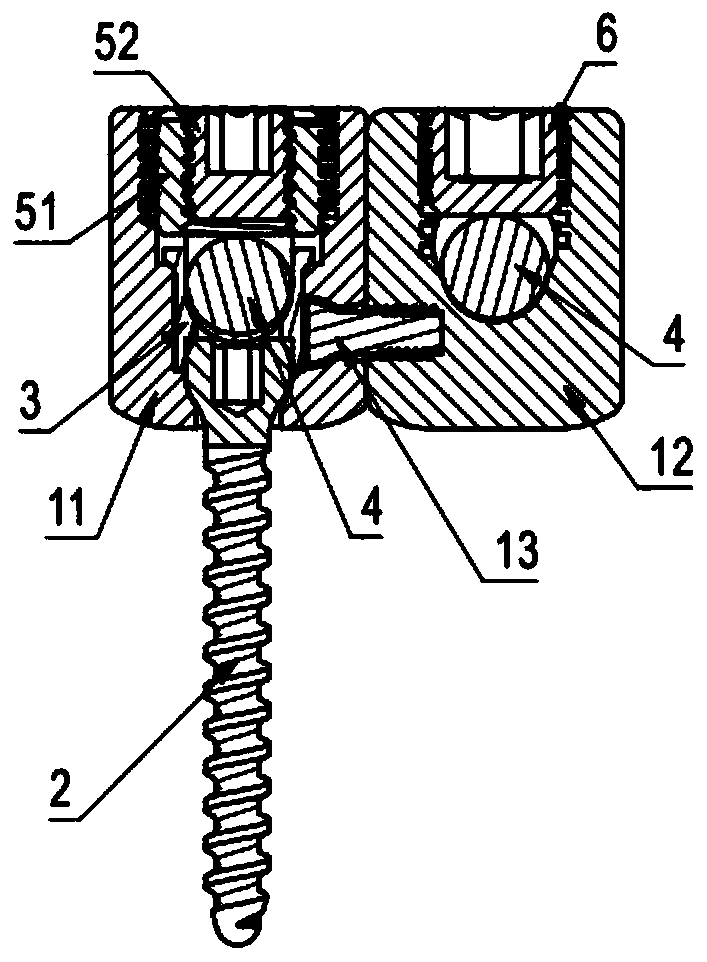 Double-headed base multi-angle plane adjustment intraspinal fixation system