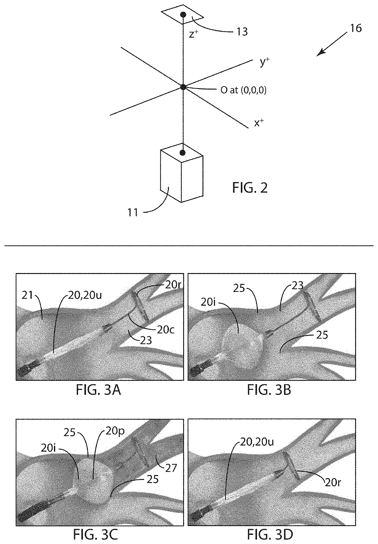 Determining and displaying the 3D location and orientation of a cardiac-ablation balloon