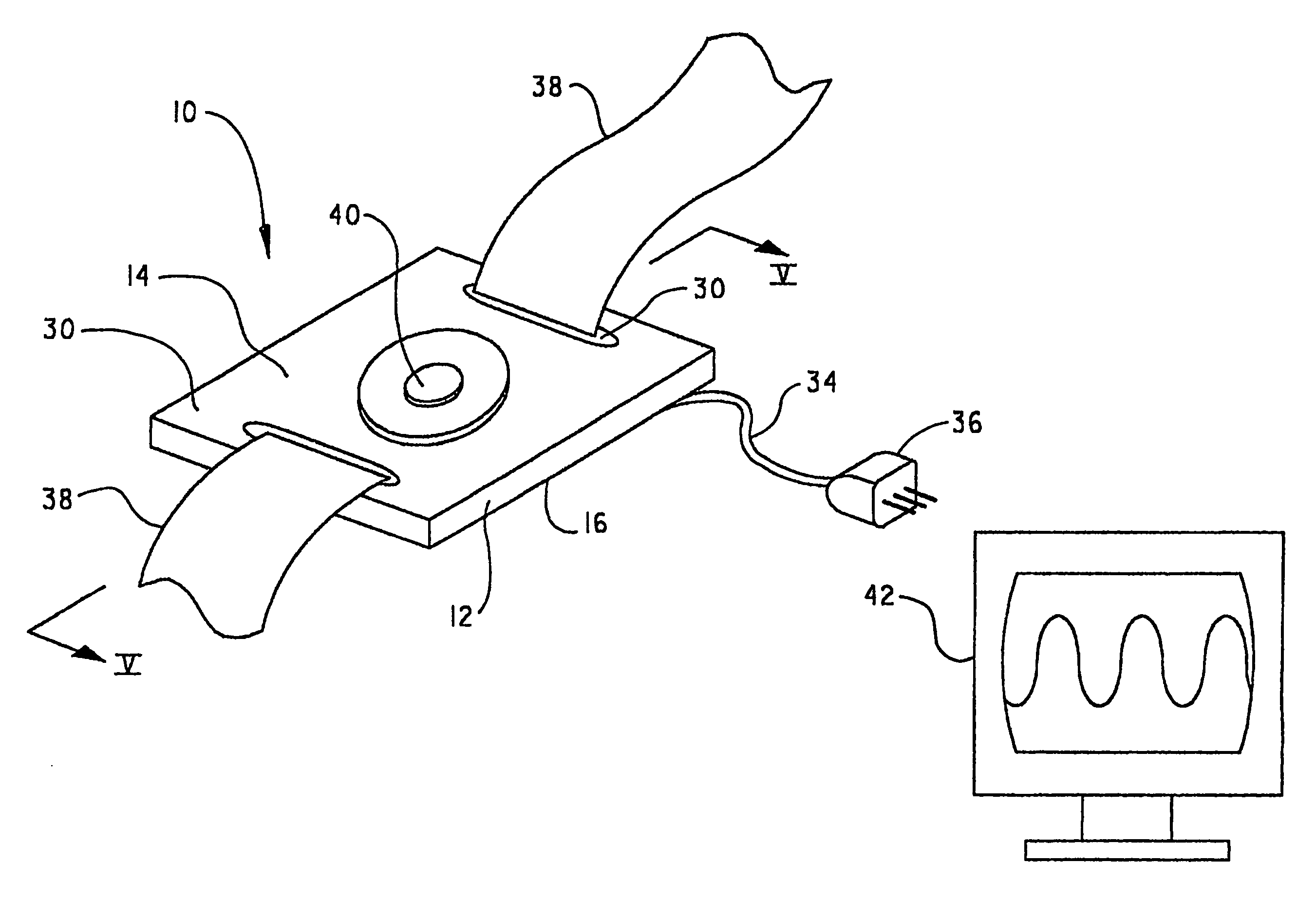 Capacitive uterine contraction sensor