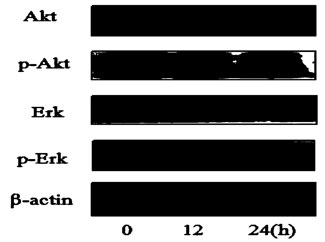 Extraction method of total saponins of trillium tschonoskii and pharmaceutical application thereof