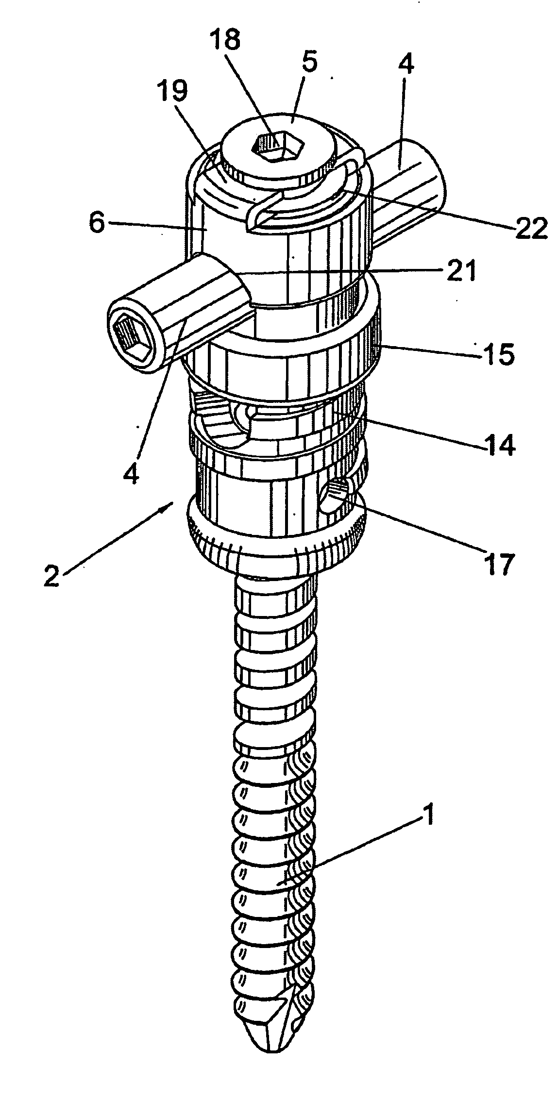 Vertebral fixation device for the treatment of spondylolisthesis