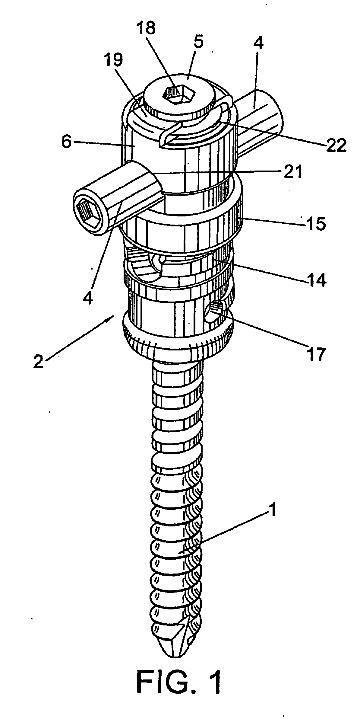 Vertebral fixation device for the treatment of spondylolisthesis