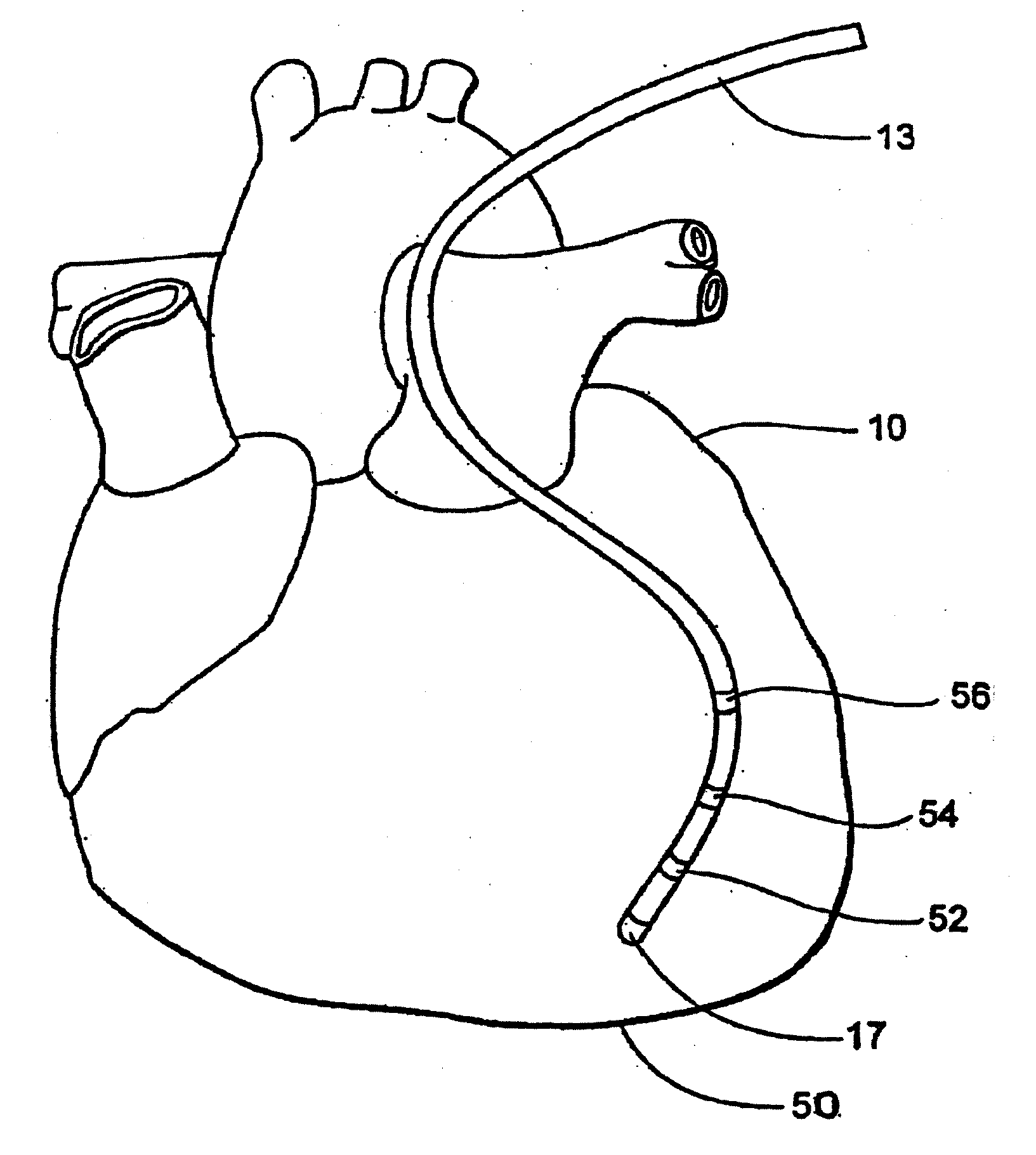 Apparatus and method for positioning and retention of catheter