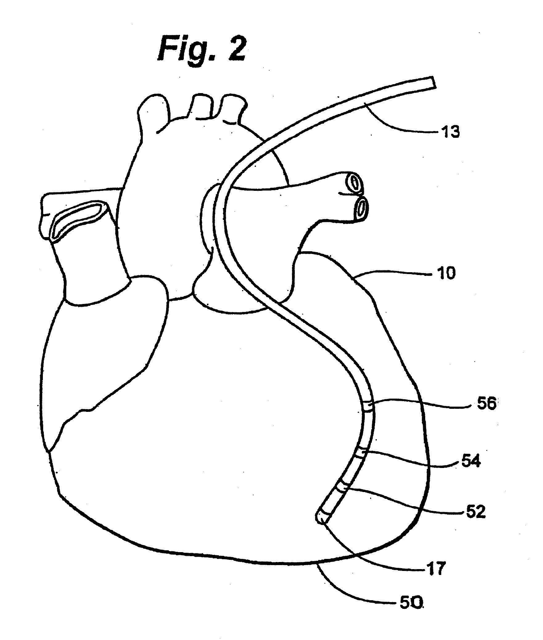 Apparatus and method for positioning and retention of catheter