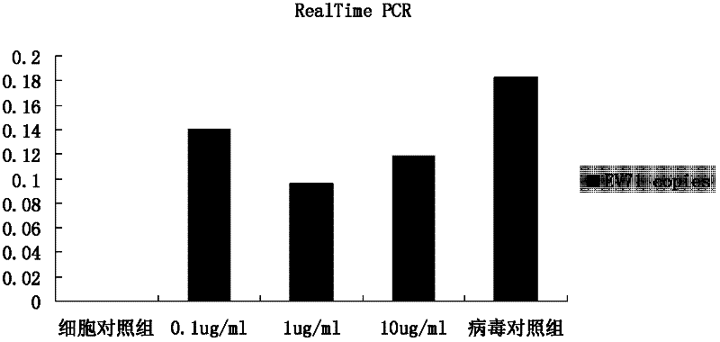 Application of matrine to medicament for treating or preventing enterovirus 71 type infection