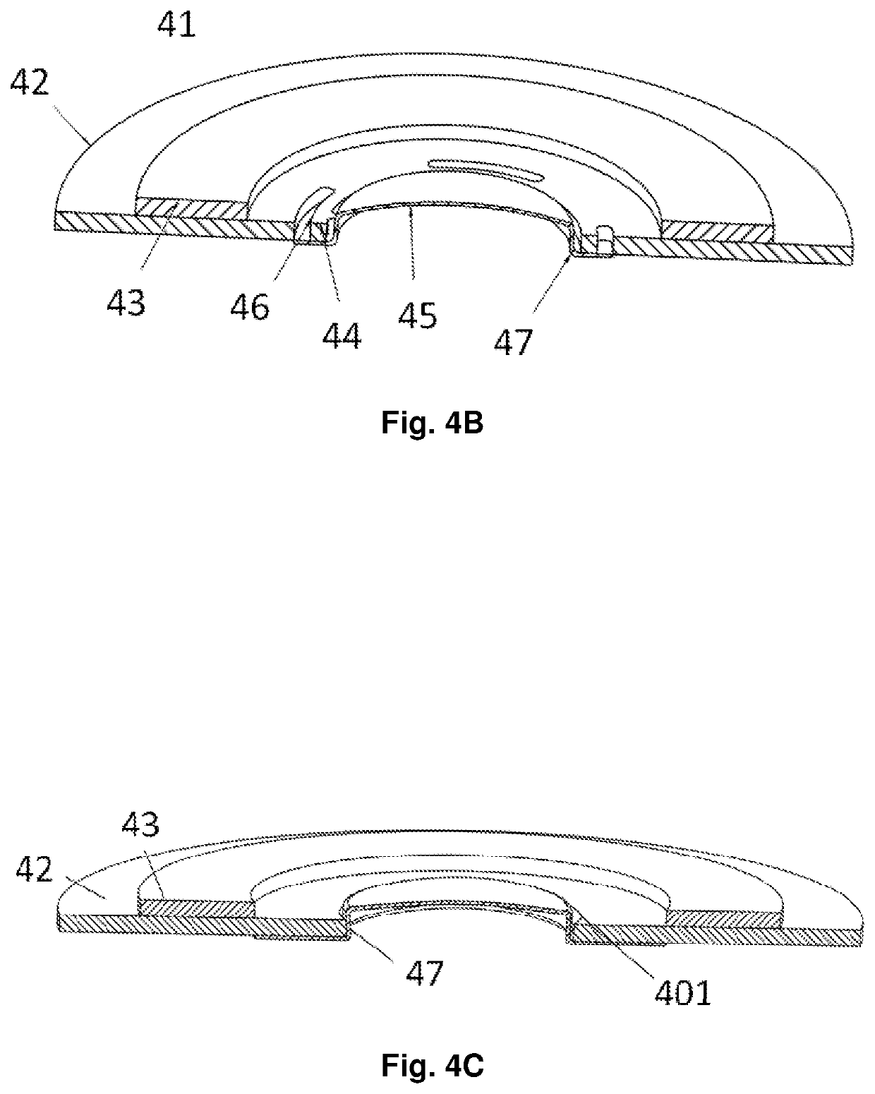 Separable membrane improvements