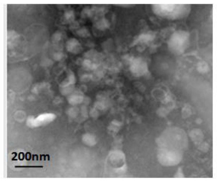 Method for preparing high-activity exosome through heterologous serum-free 3D culture of MSC stem cells