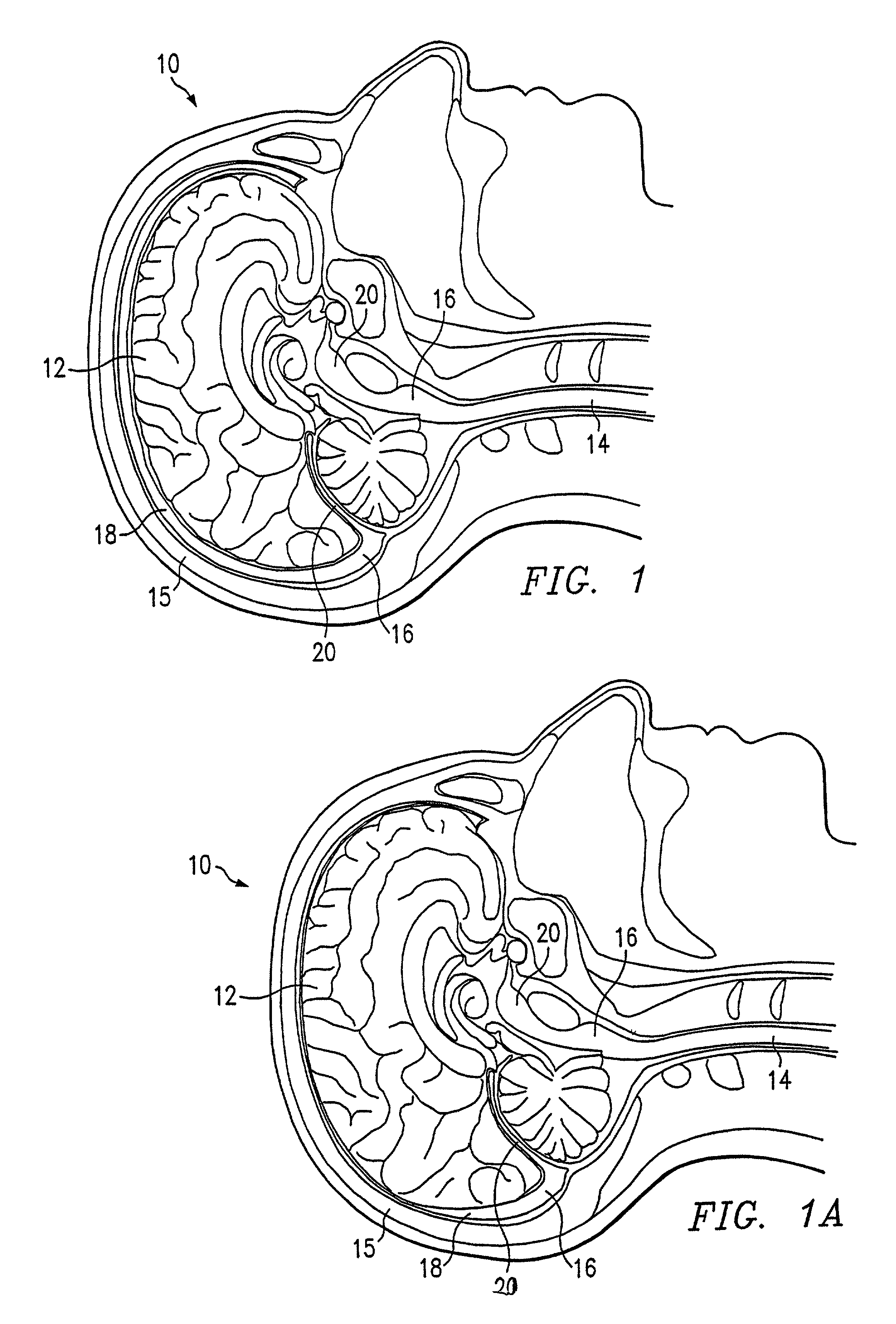 Therapeutic cooling devices