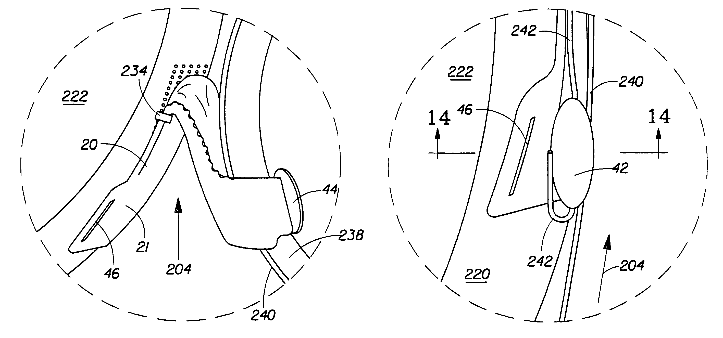 Method of dynamically pre-fastening a disposable absorbent article having a slot-and-tab-fastening system