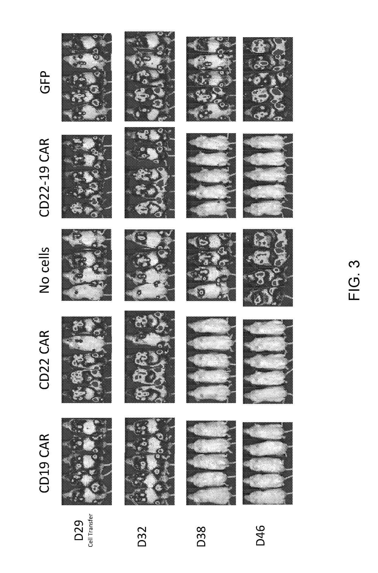 Dual specific Anti-cd22-Anti-cd19 chimeric antigen receptors