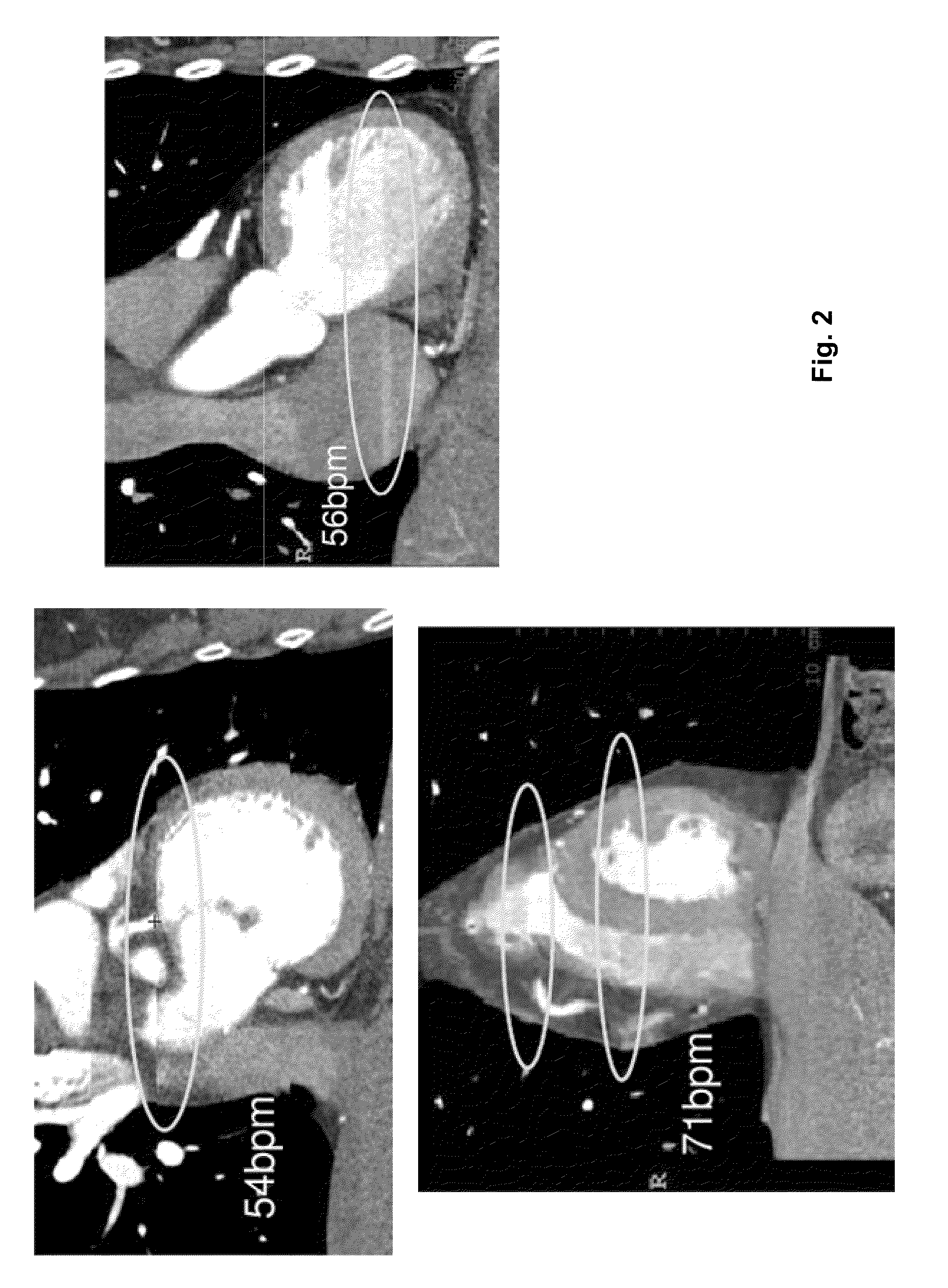 Staggered circular scans for ct imaging