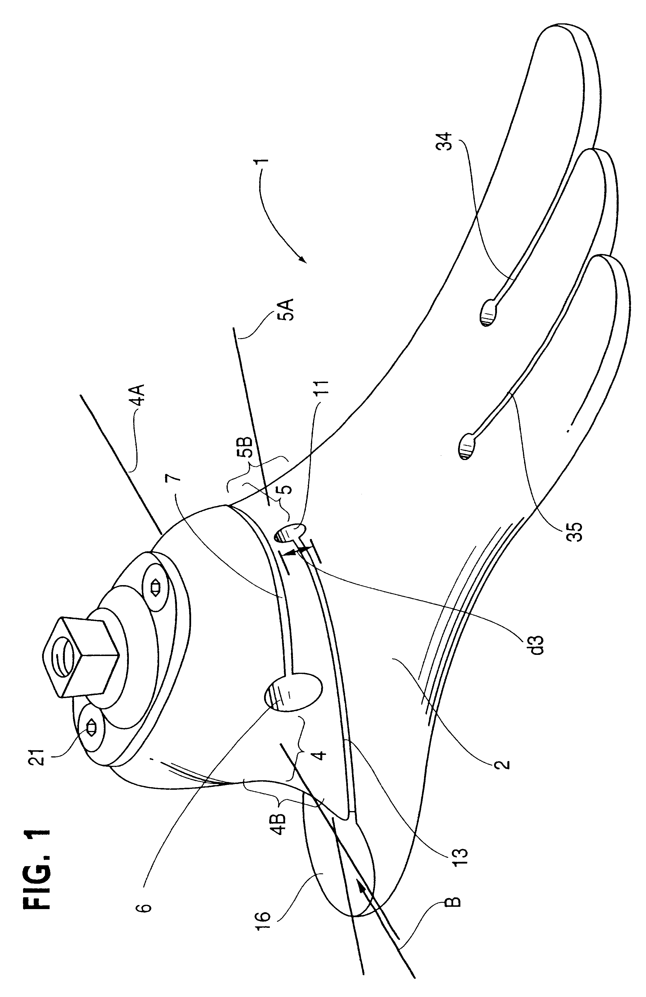 Prosthetic foot