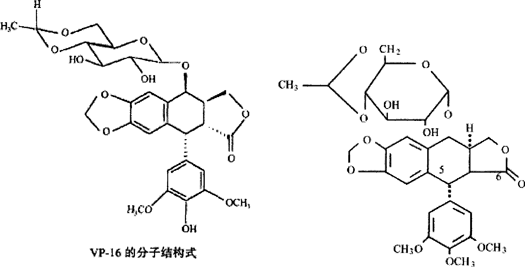 Sodium alginate microspheres blood vessel suppository containing etoposide and preparation method and uses thereof