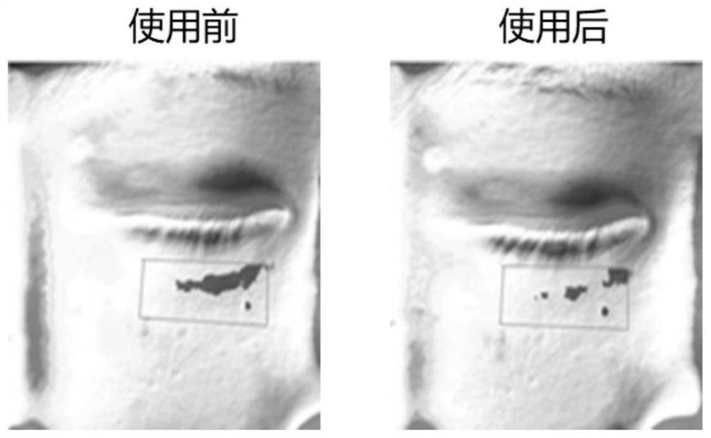 Eye repair composition as well as preparation method and application thereof