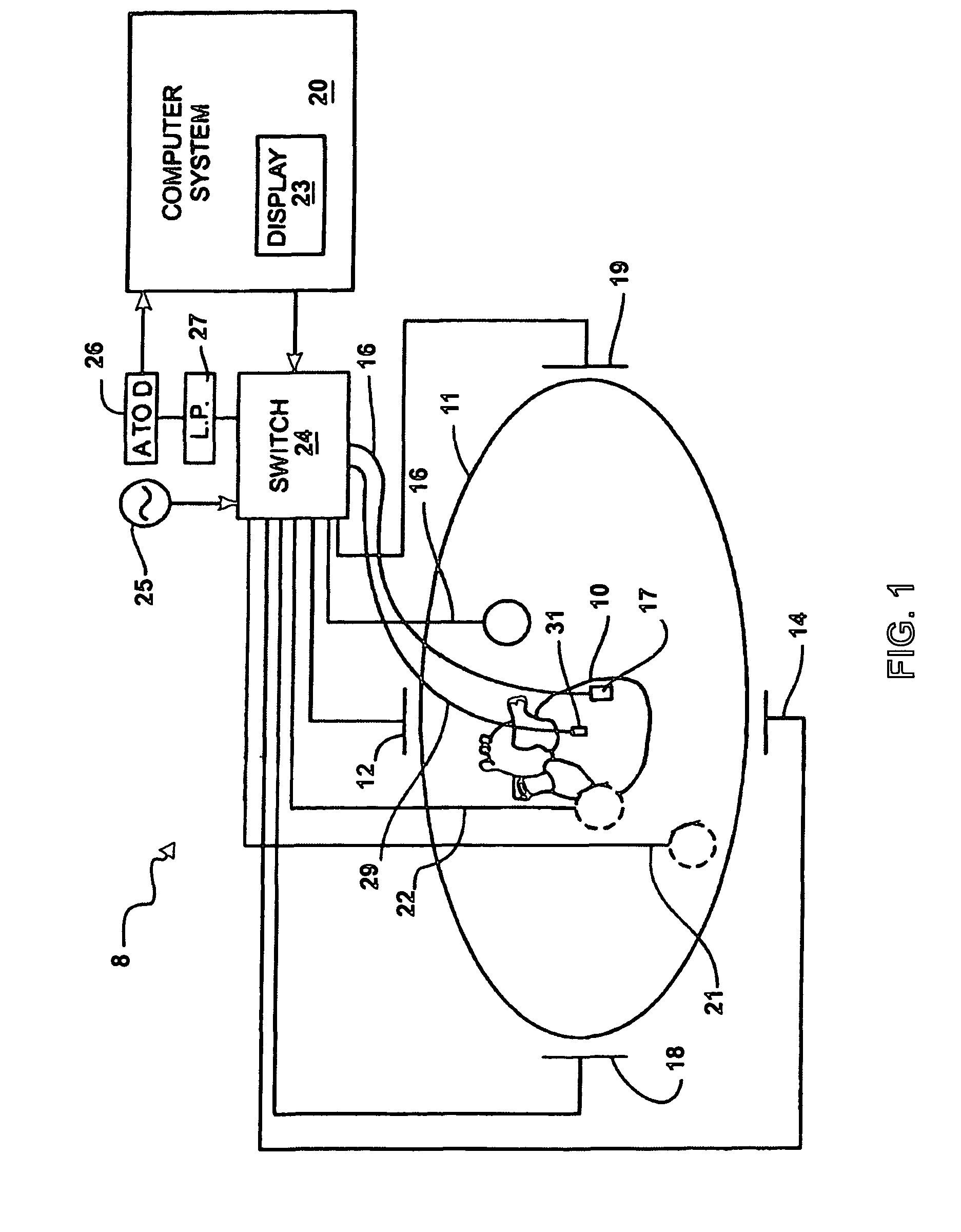 System and method for complex geometry modeling of anatomy using multiple surface models