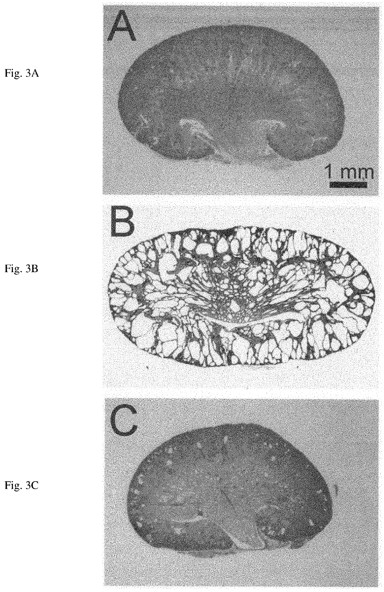 Methods of treating polycystic kidney disease