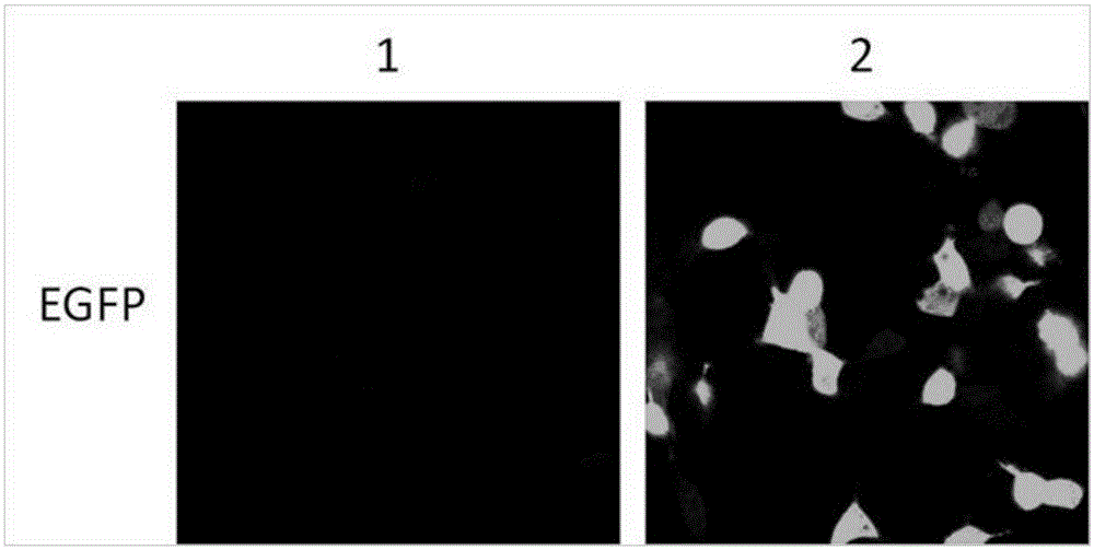 Establishing method of logic and gate gene circuit for detecting bladder cancer