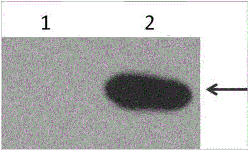 Establishing method of logic and gate gene circuit for detecting bladder cancer