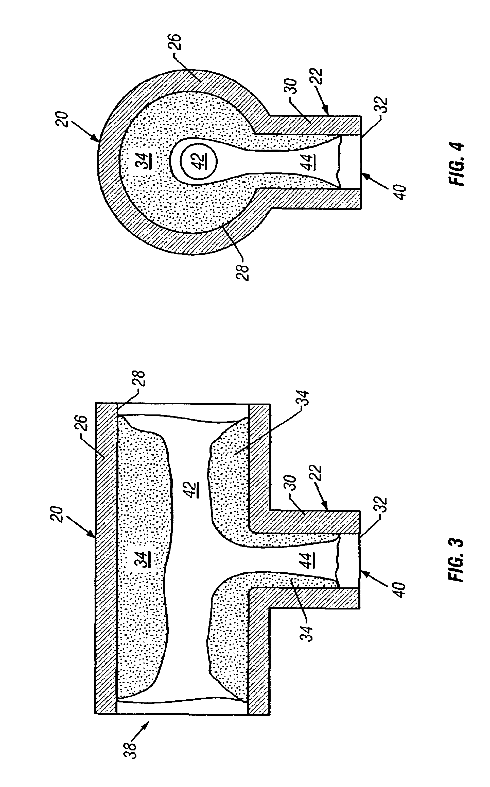 Method for surgically restoring coronary blood vessels