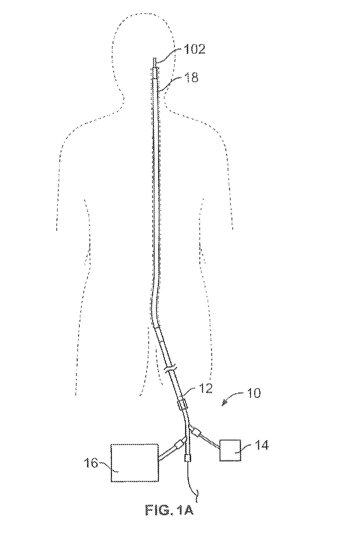 Complex wire formed devices