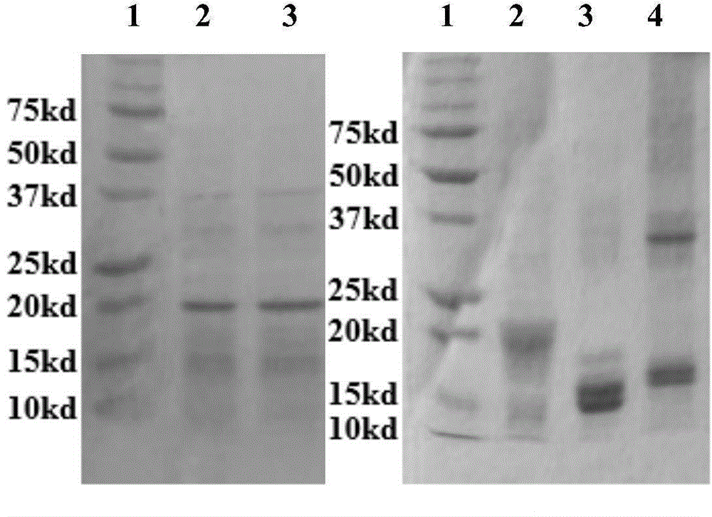 Genetically engineered antibody of anti-rabies virus as well as preparation method and application of genetically engineered antibody