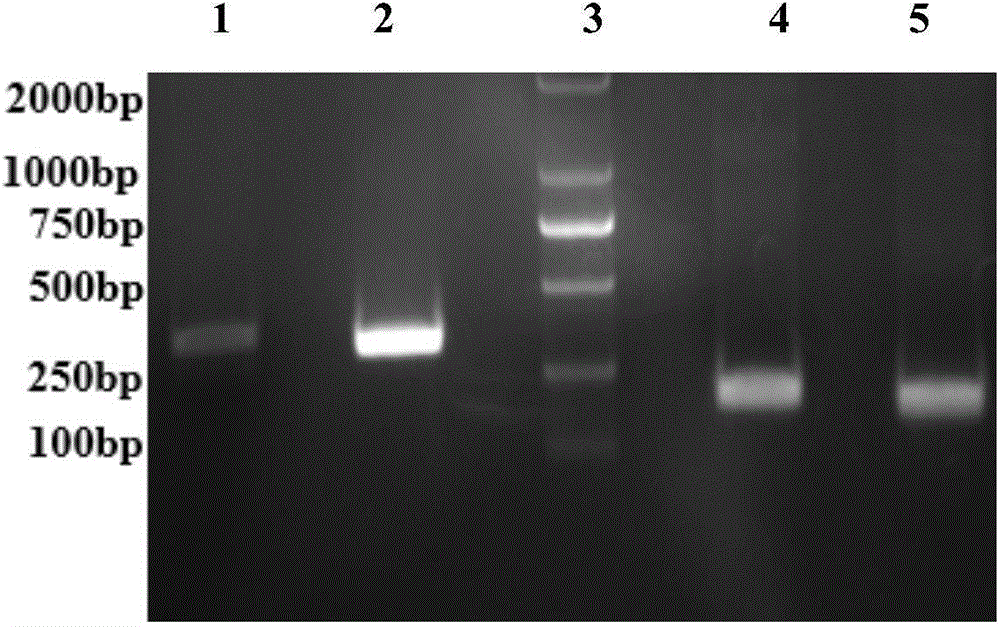 Genetically engineered antibody of anti-rabies virus as well as preparation method and application of genetically engineered antibody