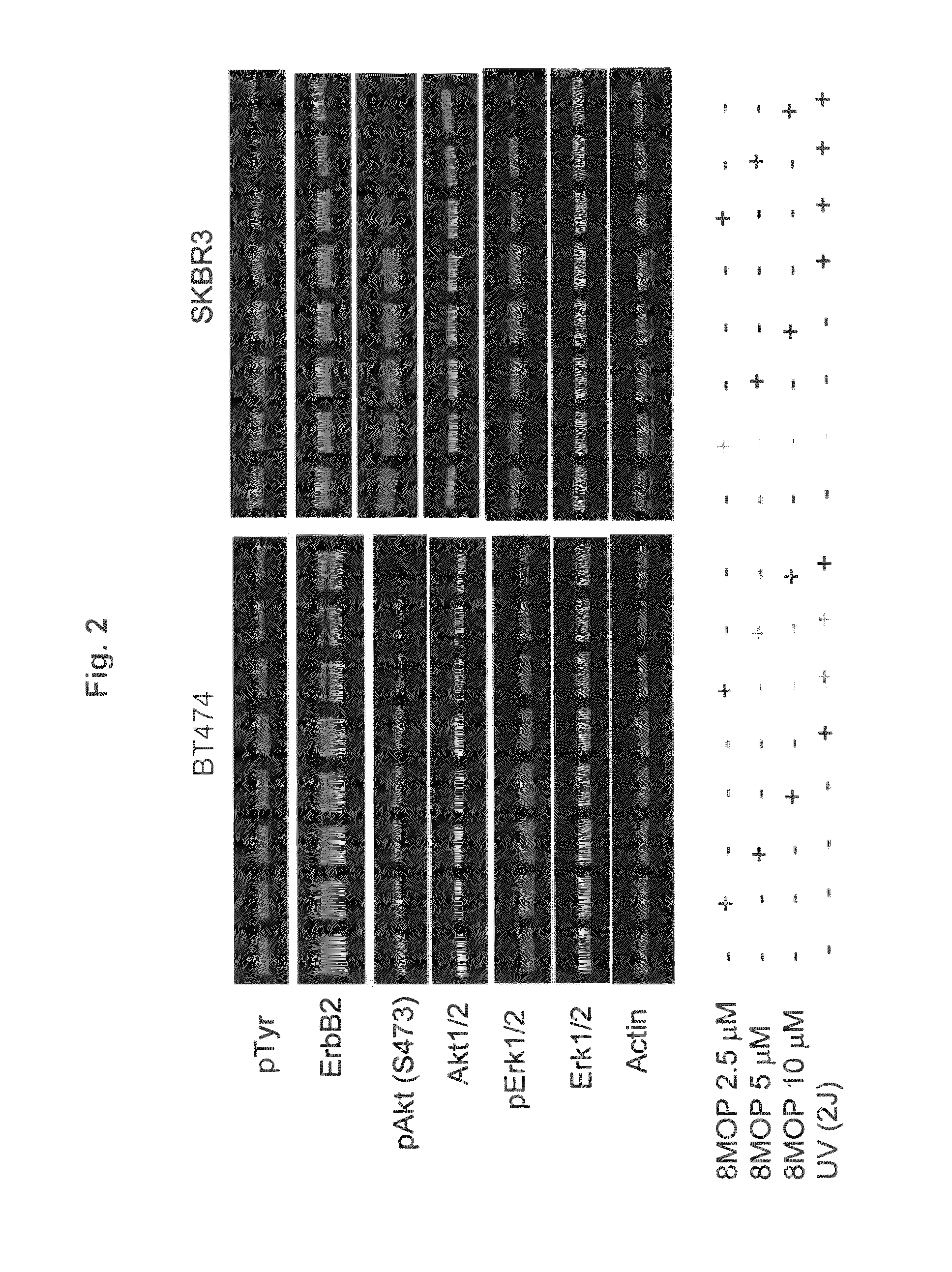 Use of psoralen derivatives and combination therapy for treatment of cell proliferation disorders