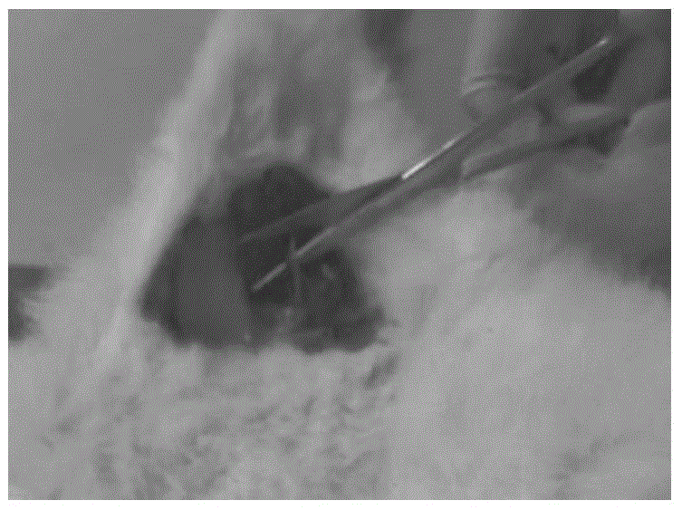 A kind of arterial hemostatic dressing and its preparation method