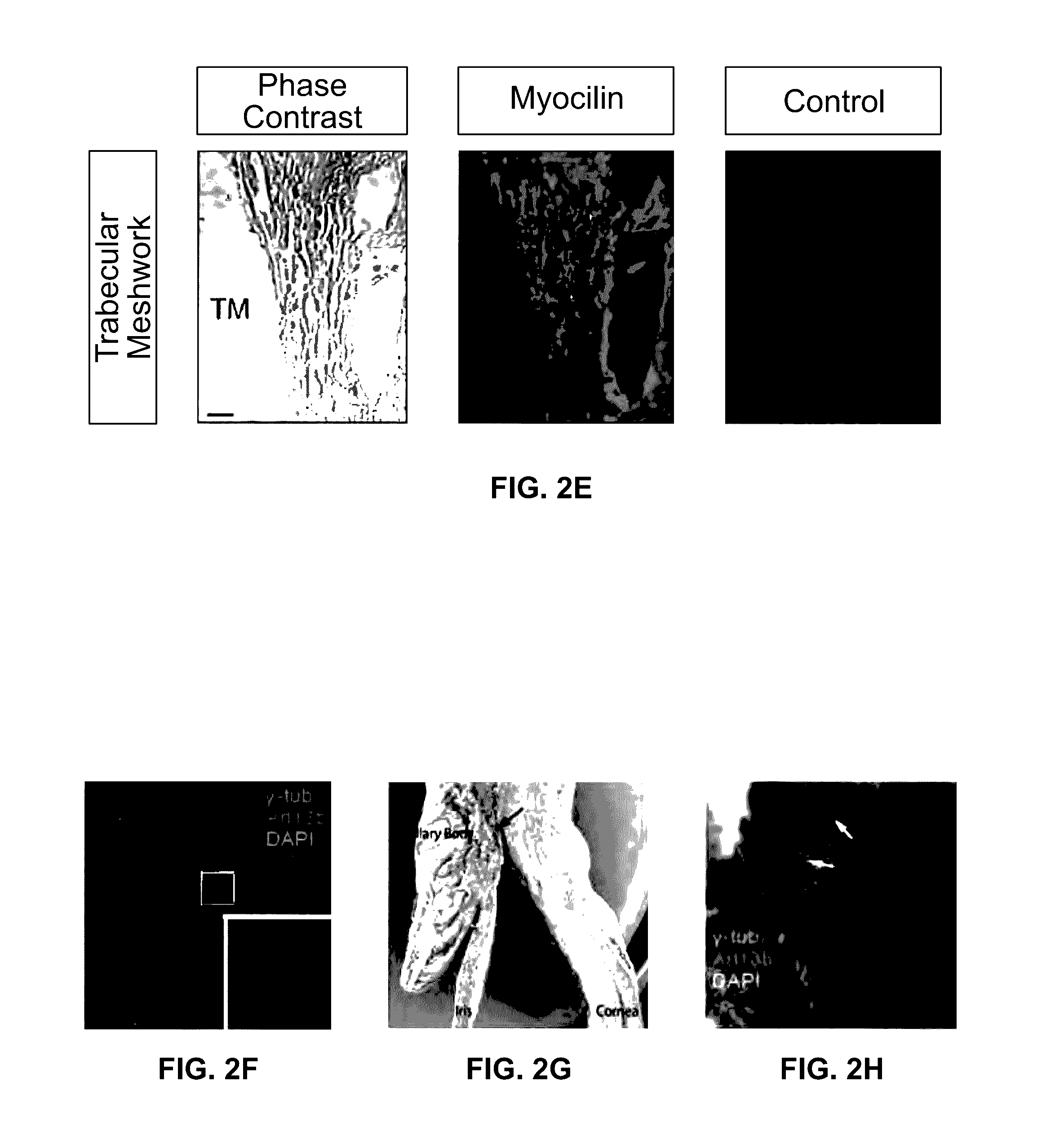 Targeting primary cilia to treat glaucoma