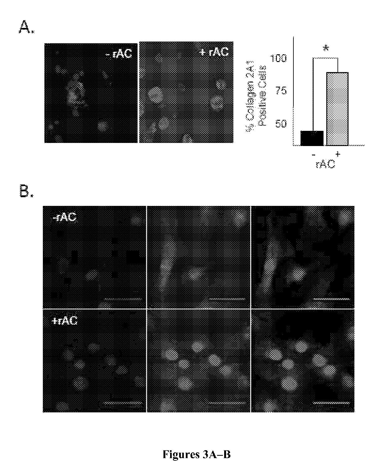 Ceramidase and cell differentiation