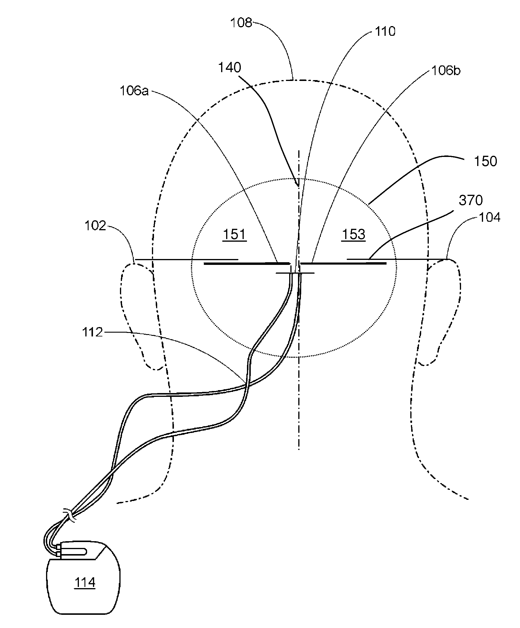 Occipital neuromodulation method