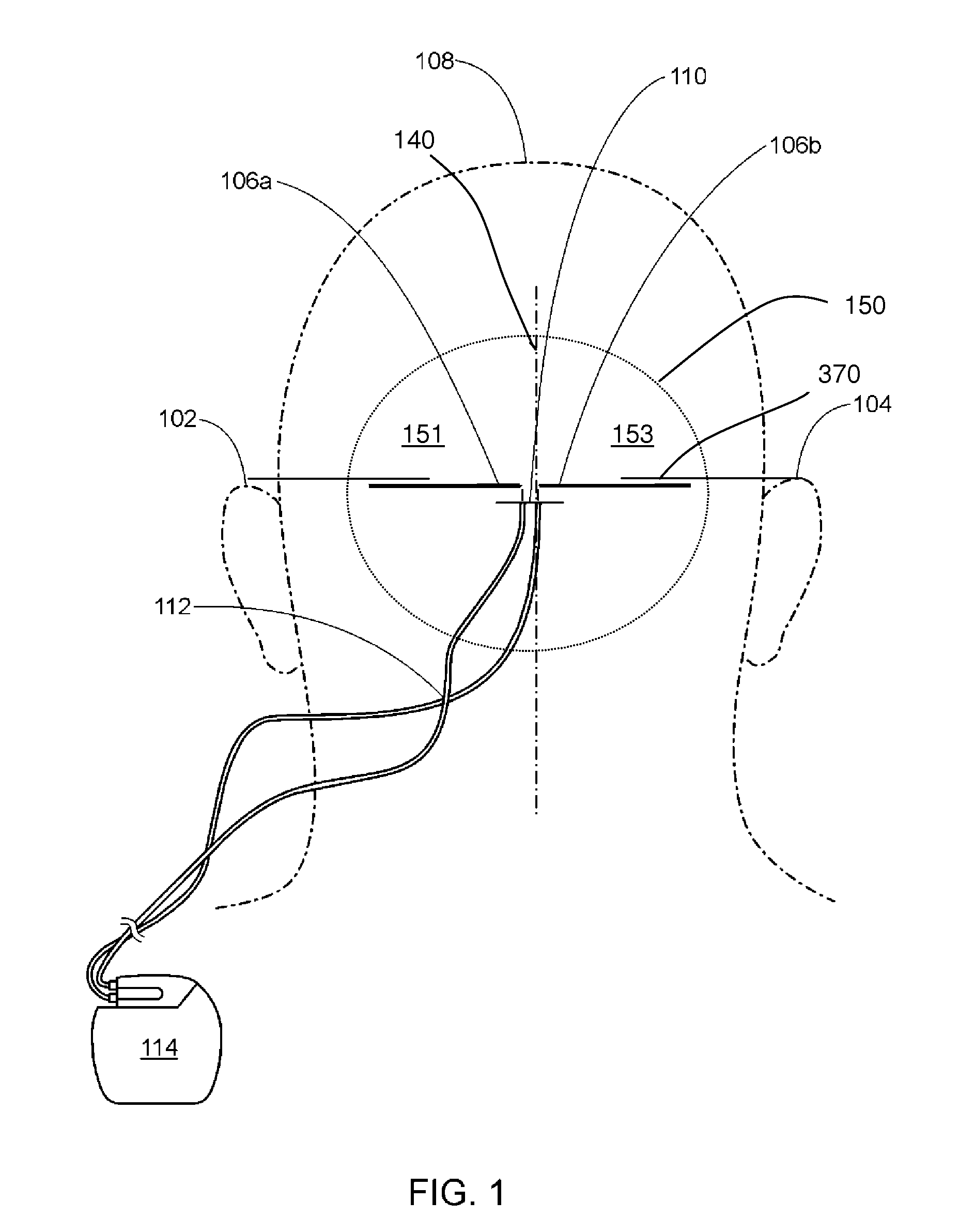 Occipital neuromodulation method