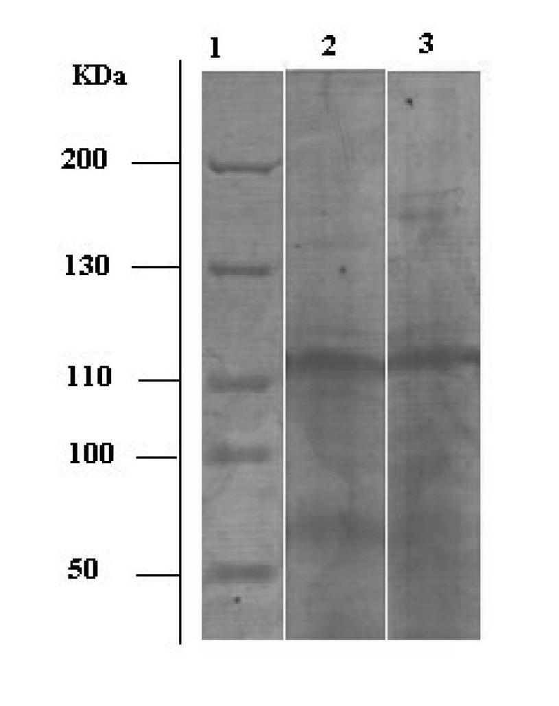 Purification method of acetylcholinesterase from earthworm serum