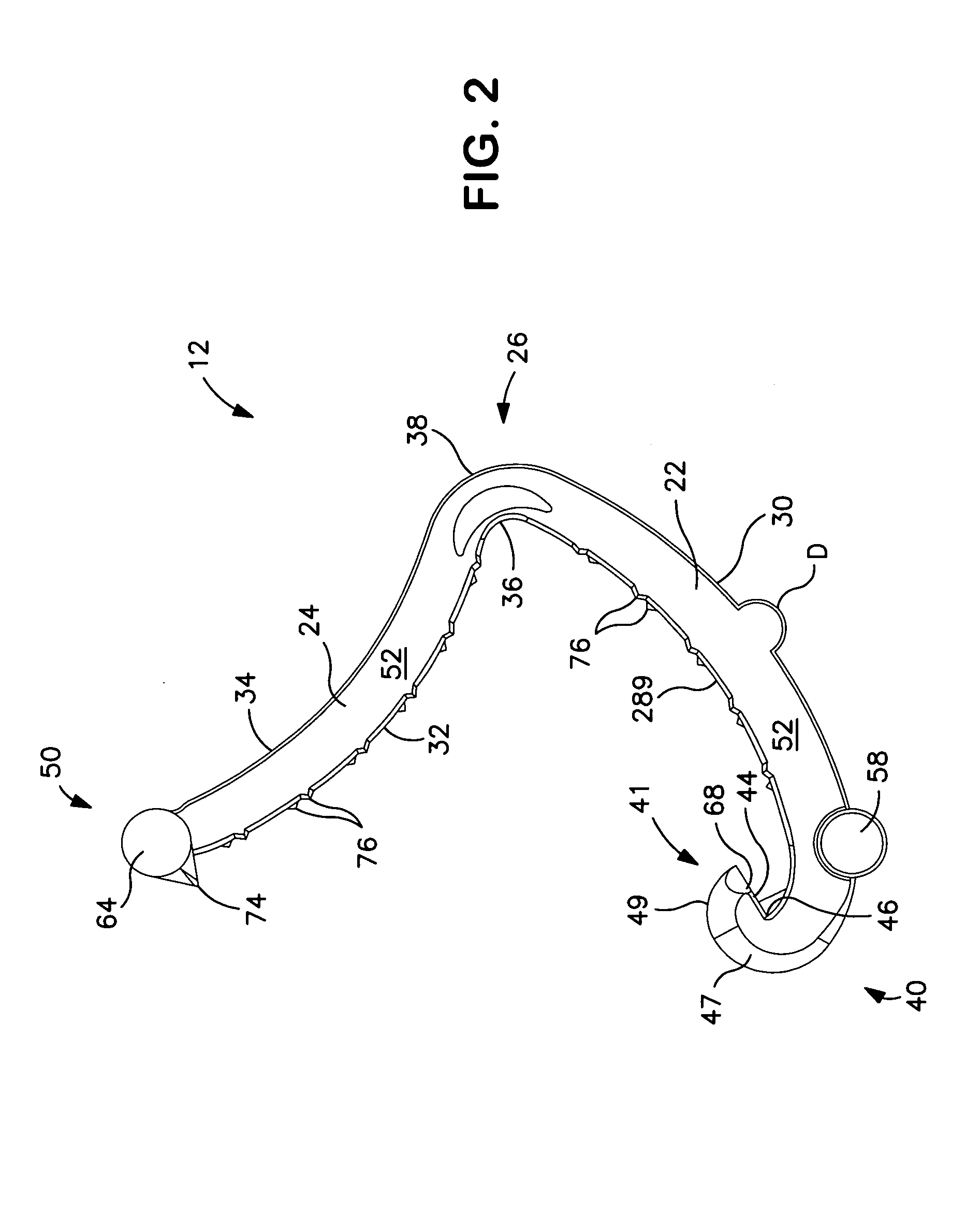 Reduced closure force ligating clip