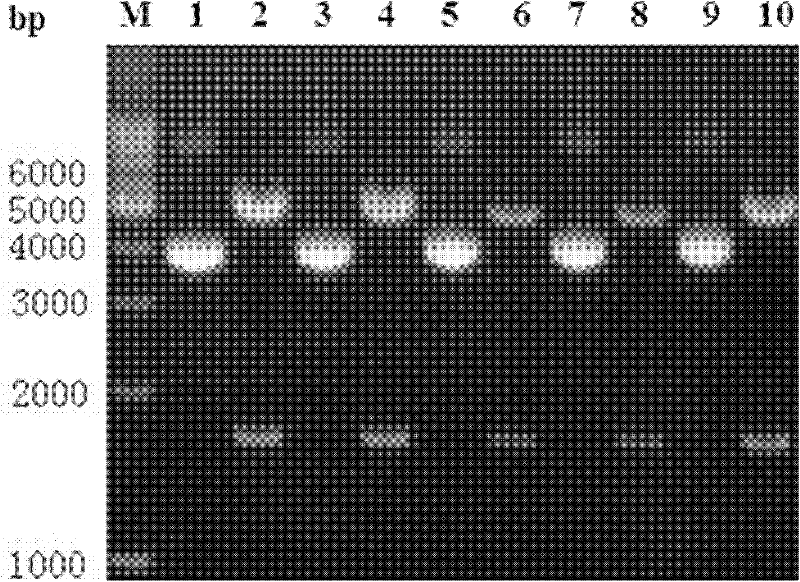 Clostridium difficile exotoxin B amino-terminal gene sequence with optimized codon and nucleic vaccine of clostridium difficile exotoxin B