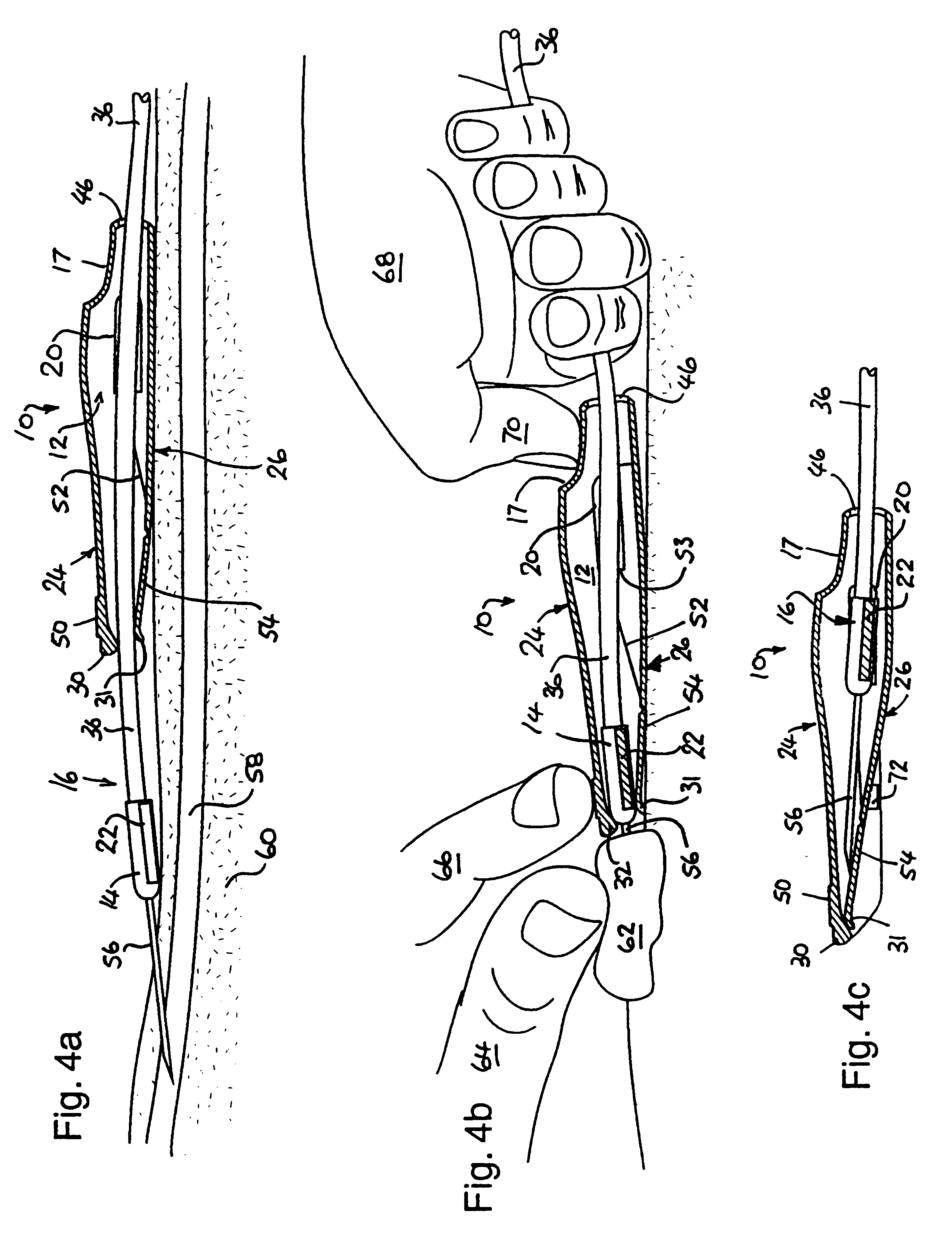 Needle guard and assembly