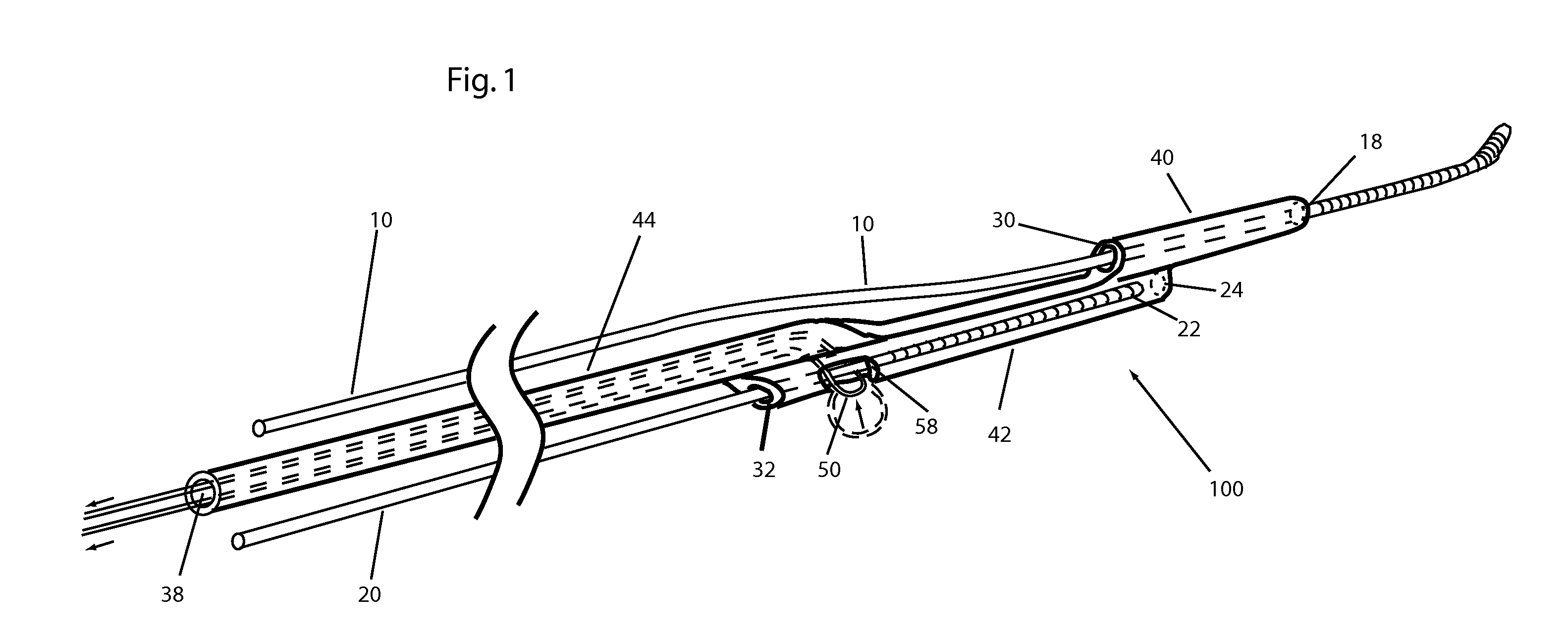 Guide wire exchange catheter system