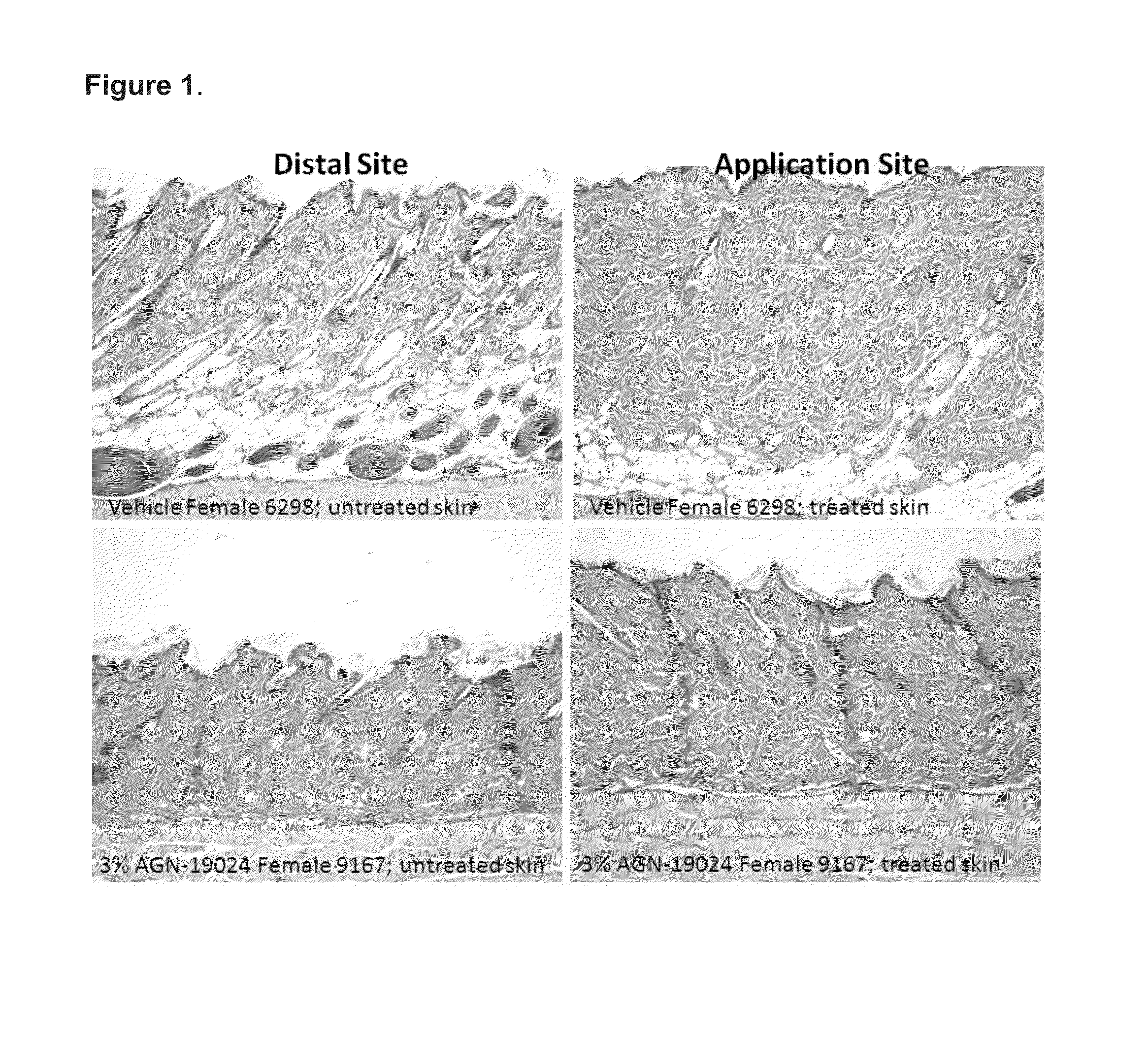 Prostamides for enhancement of leptin production