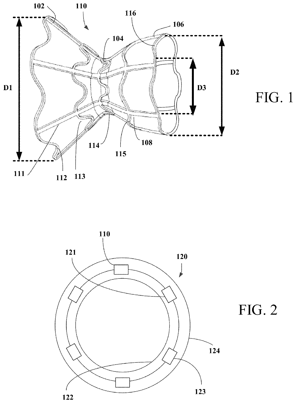 Systems and methods for making encapsulated hourglass shaped stents